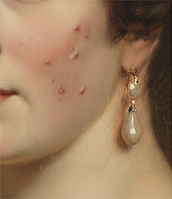 피부클리닉 이미지