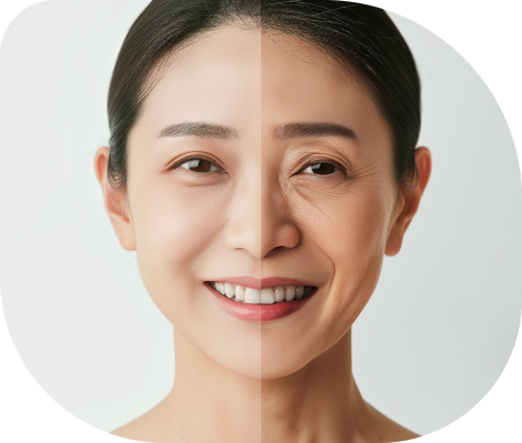 레벨온 써마지 포인트 이미지