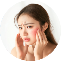 염증성 여드름을 겪는 여자