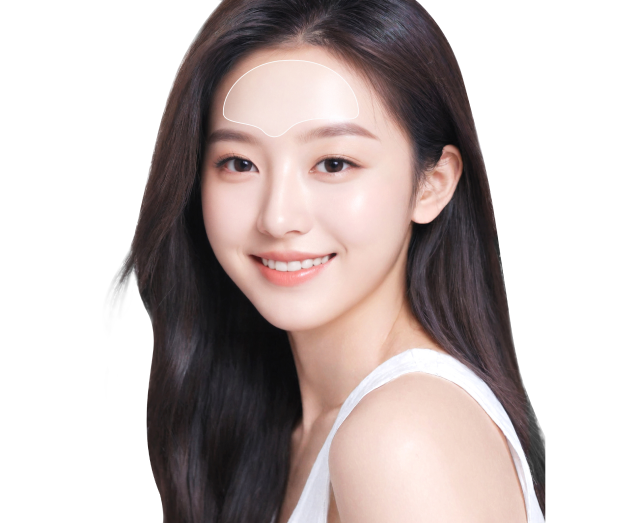 이노벨 전체 시술