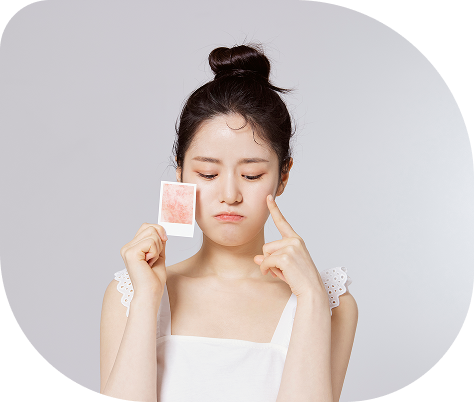 피부색조 고민 이미지